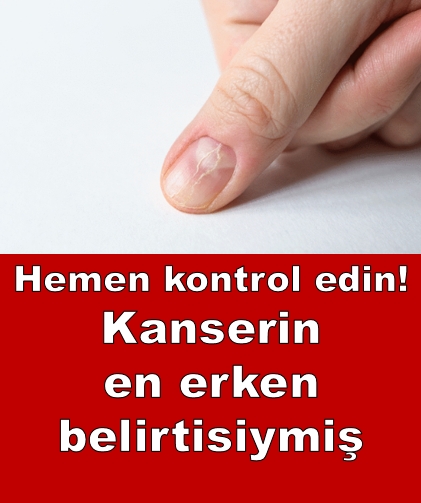 Hemen kontrol edin! En erken belirtisiymiş galerisi resim 1