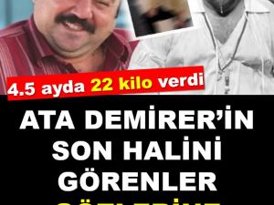 Ata Demirer Her Geçen Gün Eriyor