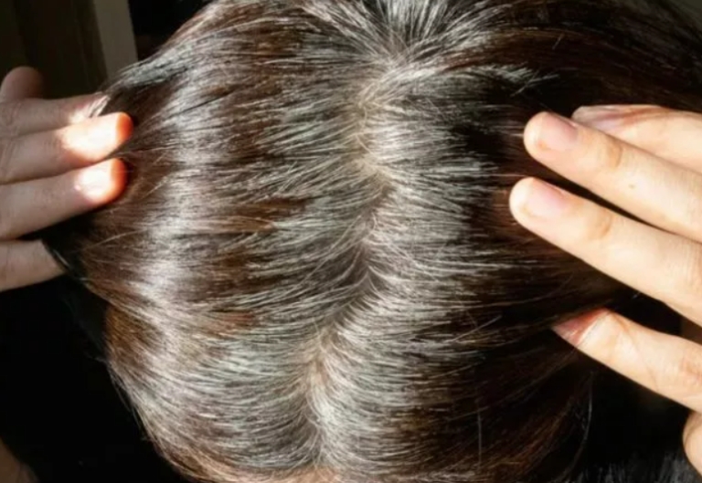 Hazineyi yıllarca çöpe atmışız. galerisi resim 2