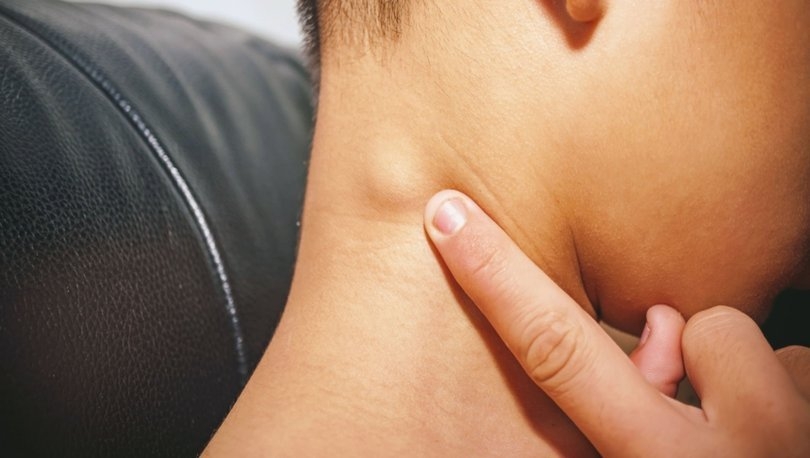 BUNLAR KANSERİN BELİRTİLERİ OLABİLİR!.. galerisi resim 5