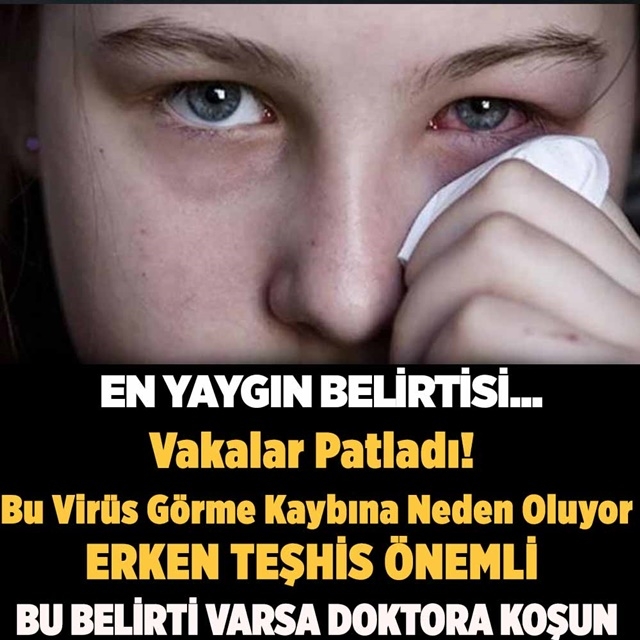 Bu Virüs Görme Kaybına Neden Oluyor galerisi resim 1