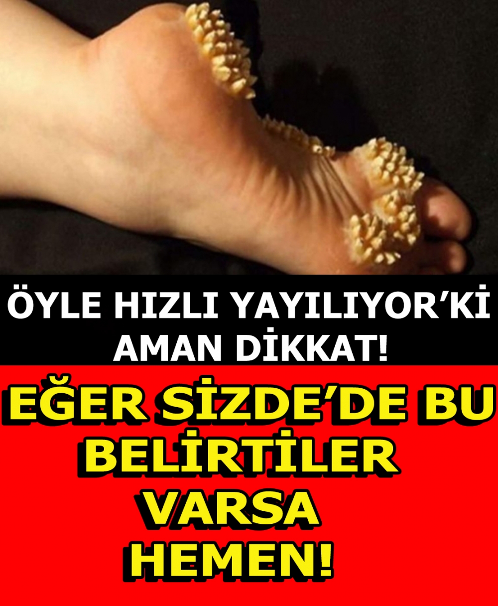 Sizde De Olabilir galerisi resim 1