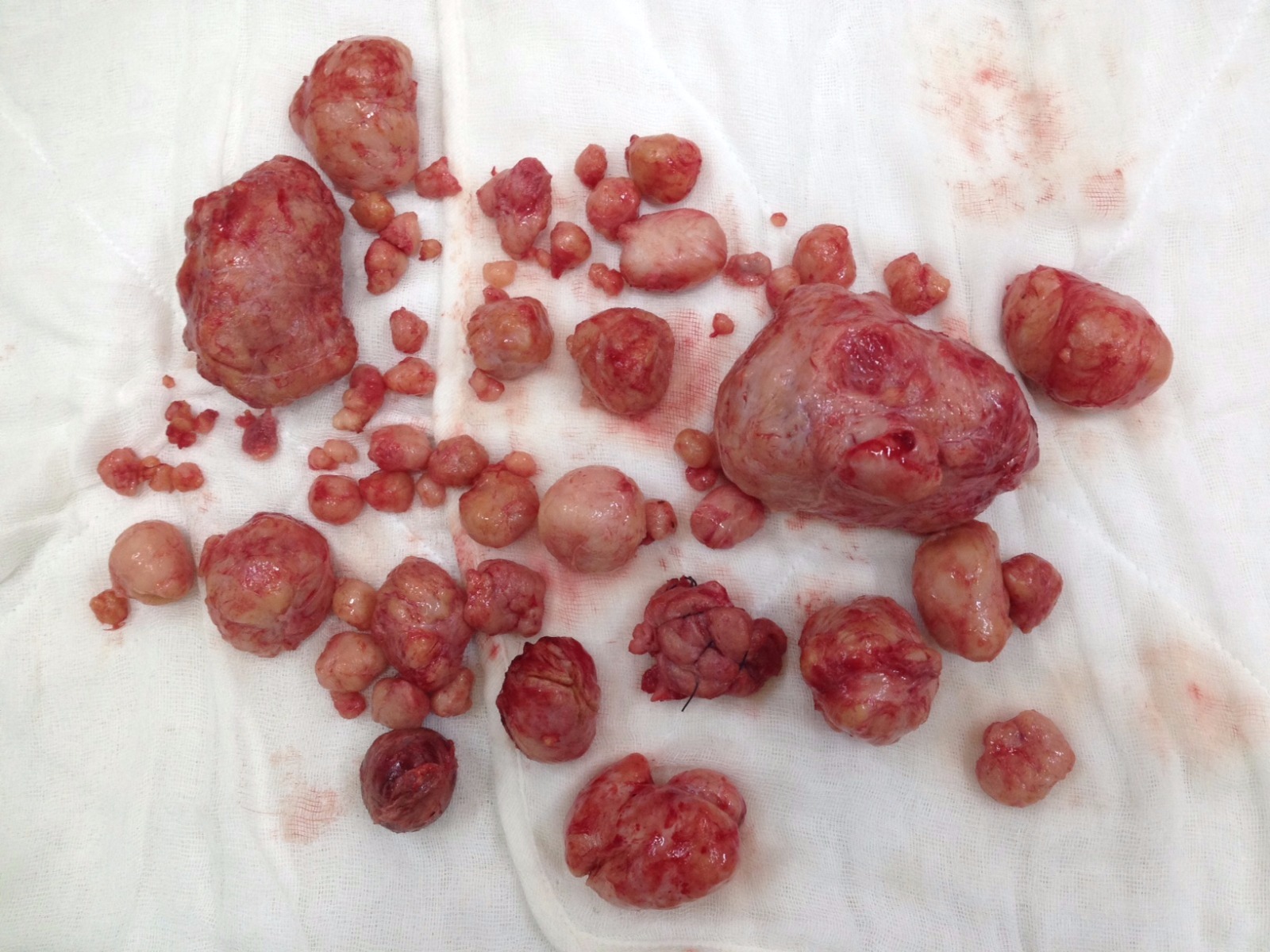 Rahminden Çıkanlara Şaşıracaksınız