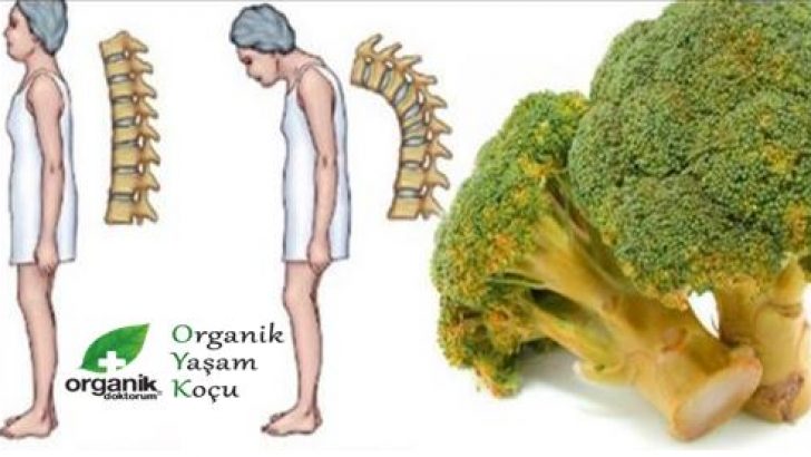 KEMİK ERİMESİNİ DURDURAN MUCİZE SEBZE “BROKOLİ”