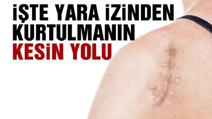 YARA İZİNDEN KURTULMANIN YOLU