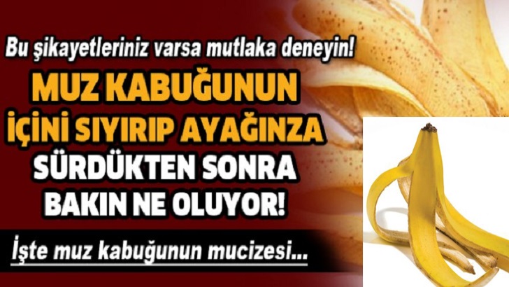 Muz Kabuğunun Faydalarına İnanamayacaksınız!