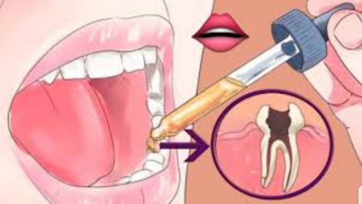 Bu Doğal Karışımla Diş Ağrısından Saniyeler İçinde Kurtulun!