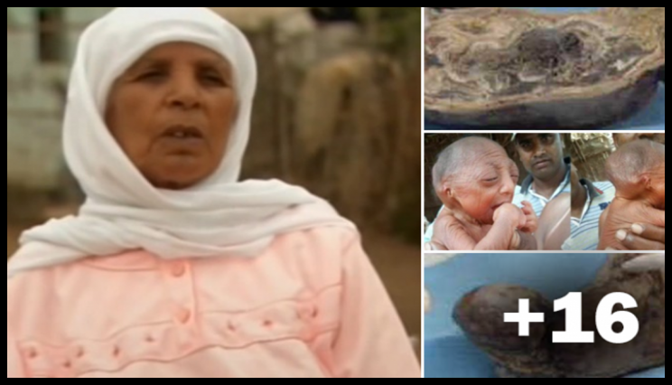 TAM 46 Yıl Hamile Kaldı.! İşte 75 Yaşına Kadar Karnında Bekleyen O Bebek!