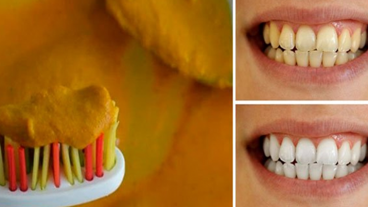 Sarı Durduğuna Bakmayın Dişleri Bembeyaz Yapıyor!