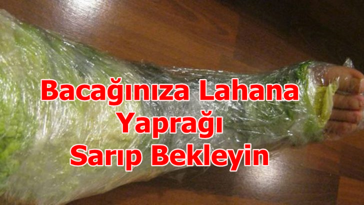 Bacağınıza Lahana Yaprağı Sarıp 1 Saat Bekleyin – Gerçekleşene Siz Bile İnanamayacaksınız