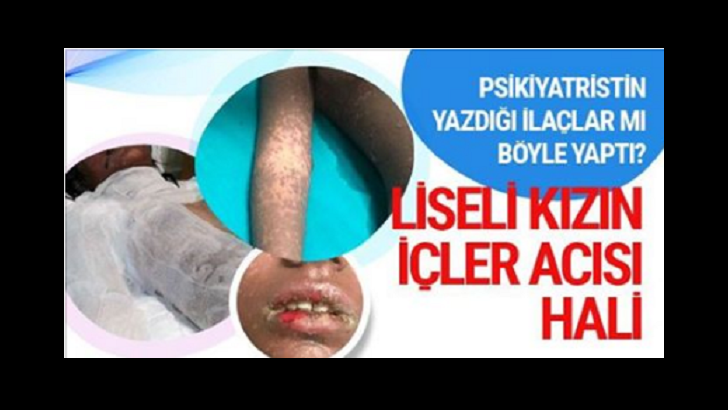 Liseli kızı bu hale getiren ne? Şok iddia! Liseli kızın içler acısı hali..!