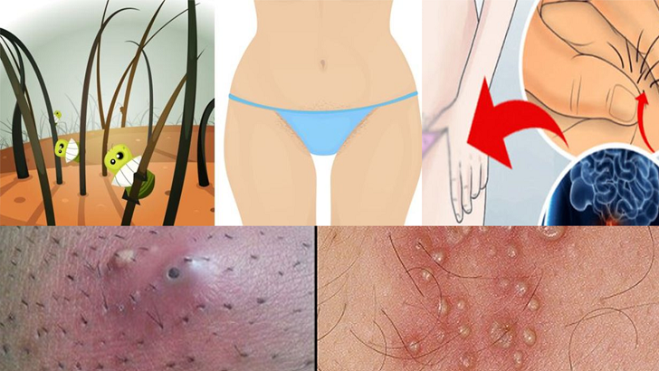 Hanımlar kasıklarınızı traş ediyorsanız bunu mutlaka okuyun!