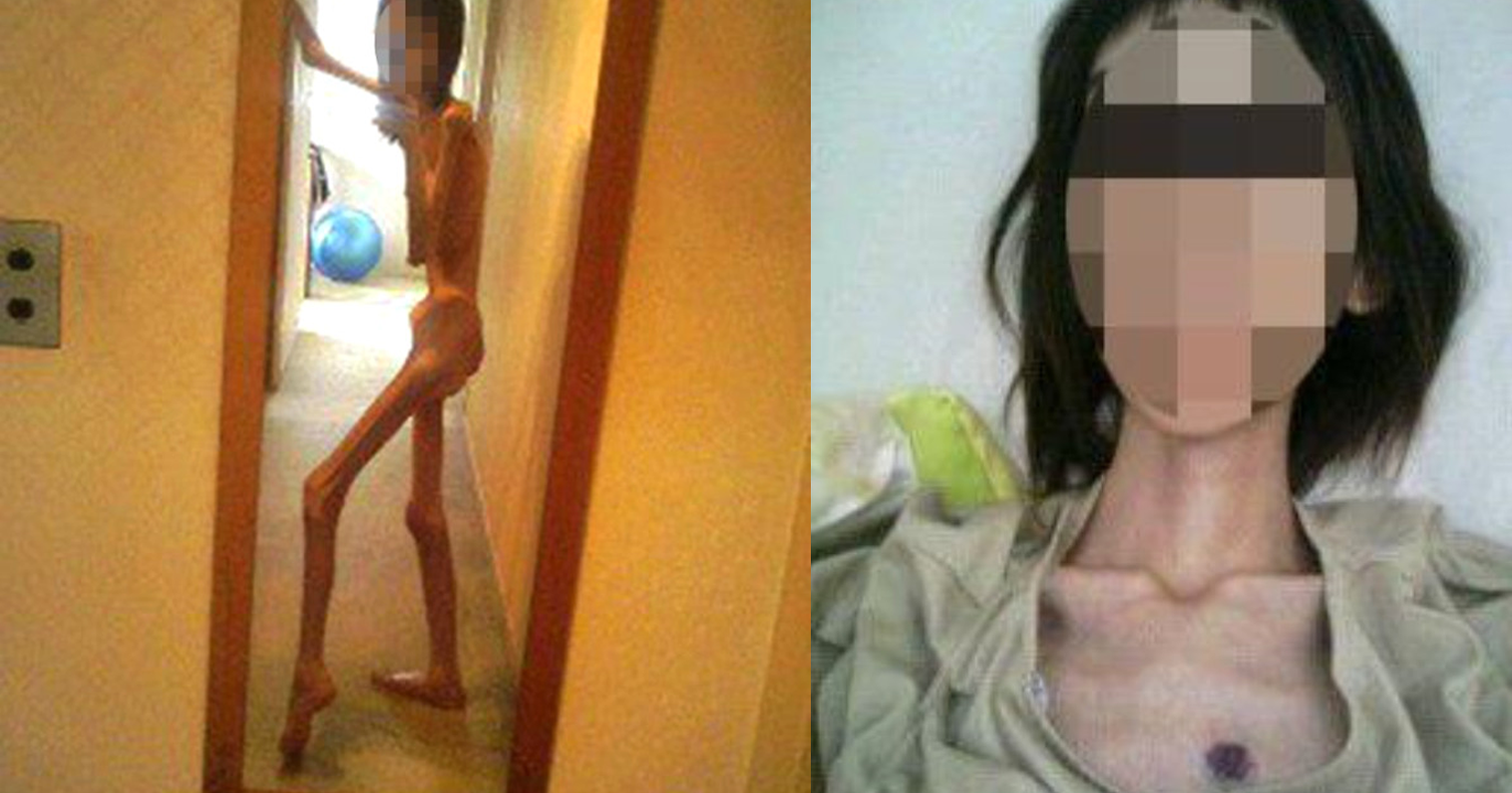 GÜNDEMİ SARSAN HABER! KÜÇÜK KIZI AÇ BIRAKARAK NE HALE SOKMUŞLAR! BAKIN KİM…