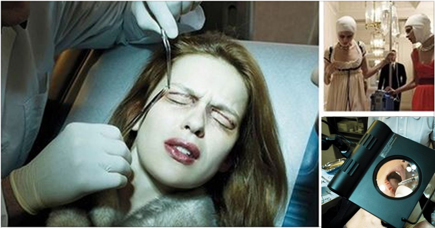 Güzel olabilmek için bu çilelere katlanıyorlar. İşte Estetik Ameliyatlarının Karanlık Yüzü