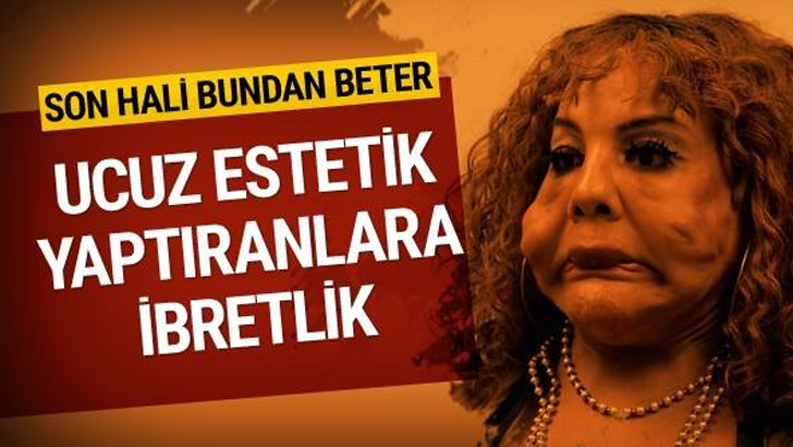 Önce cinsiyet değiştirdi sonra estetik yaptırayım dedi bu hale geldi korkunç son!