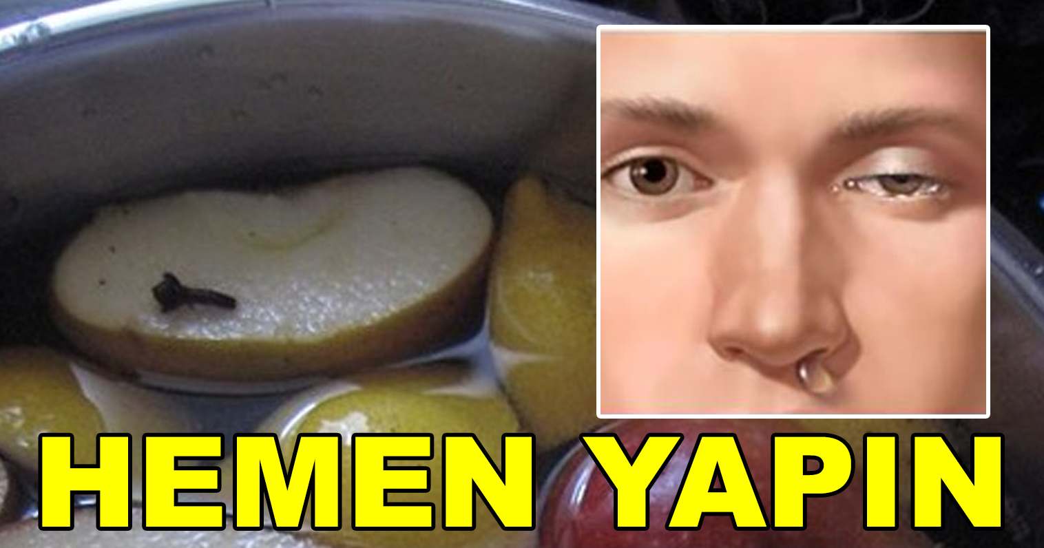 Baş Ağrısı, Düşük Enerji ve Uykusuzluğa Sahipseniz, Bunları Tüketmeye Başlayın