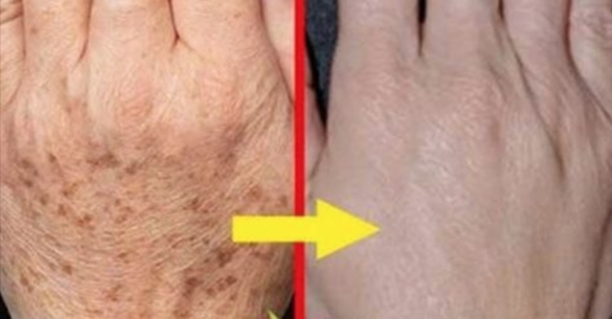 BİRKAÇ GÜNDE TÜM KIRIŞIKLIKLARDAN KURTARAN MASKE