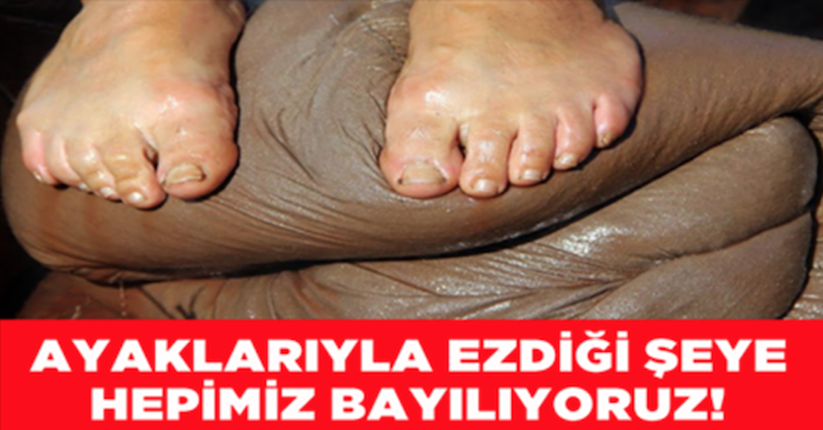 NE OLDUĞUNU GÖRÜNCE ÇOK ŞAŞIRACAKSINIZ