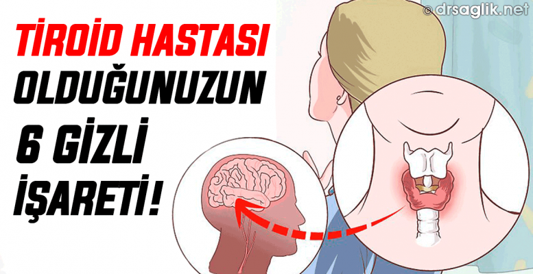 İşte Tiroid Hastası Olduğunuzun 6 Gizli İşareti