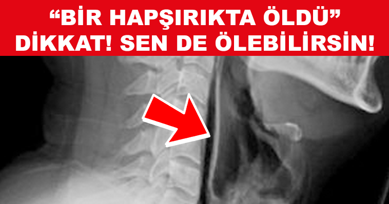ÇOK ÖNEMLİ BİR BİLGİ! HEPİMİZ "HAPŞIRIYORUZ" BİR HAPŞIRIKTA ONUN GİBİ BİZ DE ÖLEBİLİRSİNİZ NEDEN Mİ