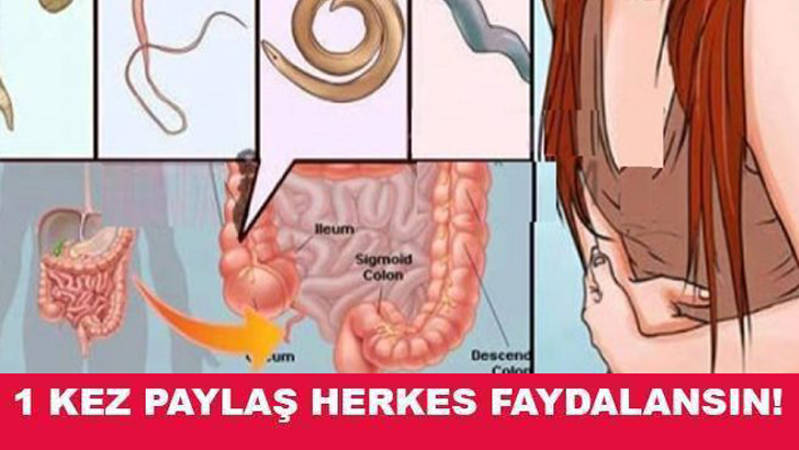 12 SAATTE BAĞIRSAKTAKİ KURTLARI DIŞARI ATAR