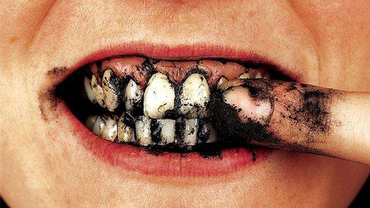 EVDE DİŞ BEYAZLATMANIN 5 KOLAY YOLU