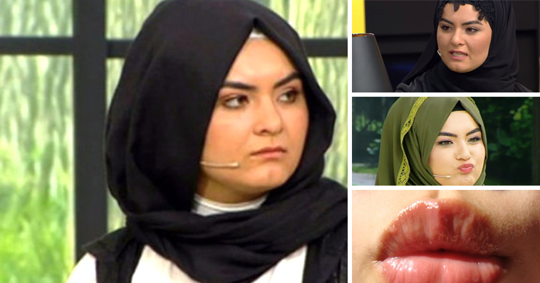 PARAYI BULUNCA BIÇAK ALTINA YATIP ESTETİK YAPTIRDI! ŞİMDİ BAMBAŞKA BİRİ