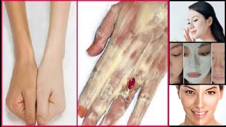 1 GECEDE CİLDİNİZ BEYAZLAYACAK HEMDE BAKIN NASIL?