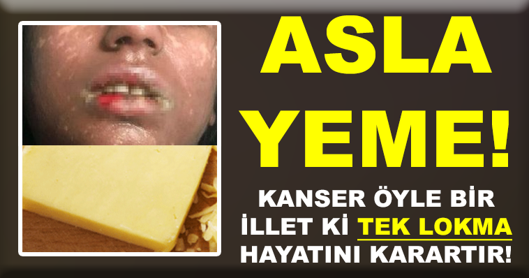 TAZE KAŞAR PEYNİRİNDE KANSER TEHLİKESİ! İÇİNE BAKIN NE KATIYORLAR