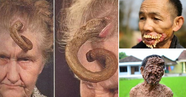 BU HASTALIKLARI GÖRÜNCE KAŞINMAYA BAŞLAYACAKSINIZ! OKUMADAN ÖNCE 2 KEZ DÜŞÜNÜN