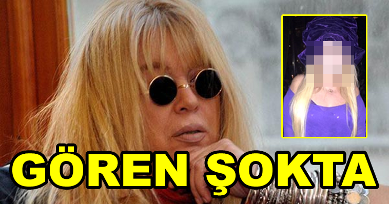 ZERRİN ÖZER BAKIN NE HALE GELDİ! GÖREN KÜÇÜK DİLİNİ YUTUYOR