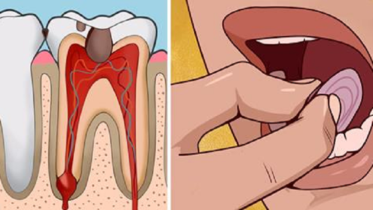 DİŞ AĞRISINI ÇEKEN BİLİR ÜZÜLMEYİN EVDE YAPABİLECEĞİNİZ AĞRIYI BIÇAK GİBİ KESECEK YÖNTEMLER VAR