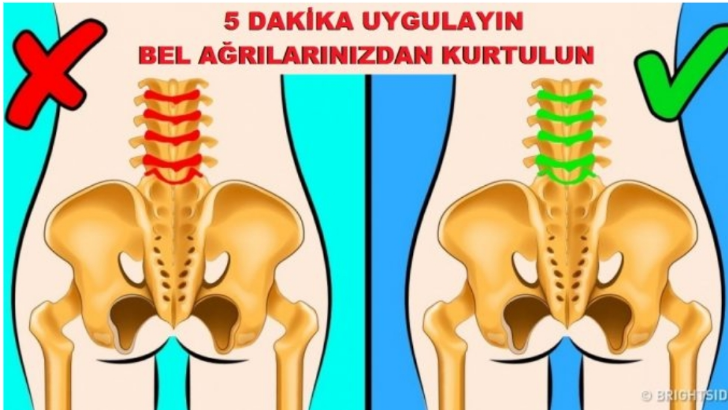 BEL AĞRISINI RAHATLATMAK İÇİN 5 DAKİKALIK EGZERSİZLER