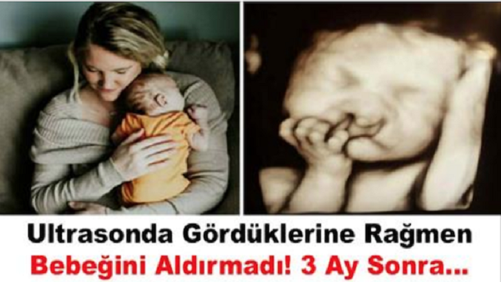 ULTRASONDA GÖRDÜKLERİNE RAĞMEN BEBEĞİNİ ALDIRMADI! 3 AY SONRA