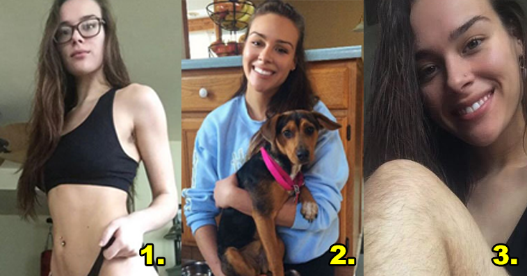 BACAK KILLARINI BİR SENEDİR ALDIRMIYOR! NEDENİ SİZİ ÇOK ŞAŞIRTACAK