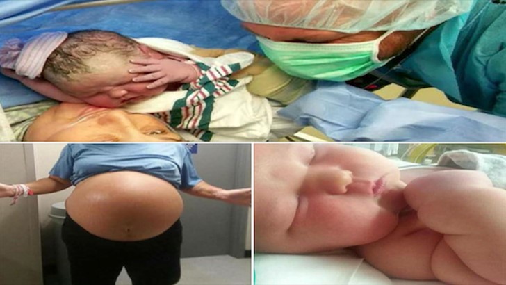 HAMİLEYDİ, KARNI SÜREKLİ ŞİŞİYORDU AMA ŞİŞME DURMUYORDU