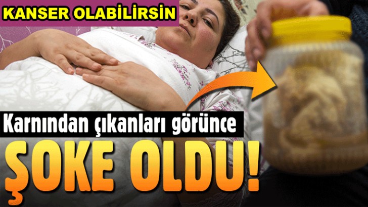 KANSER OLABİLİRSİN DENİLDİ, KARNINDAN ÇIKAN HERKESİ ŞOK ETTİ