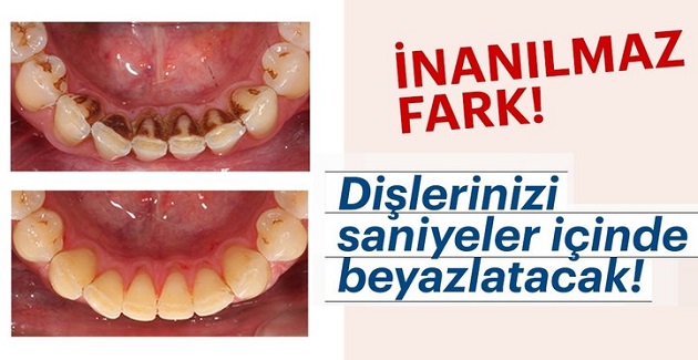 Evde 3 Dakikada Dişlerinizi Beyazlatın
