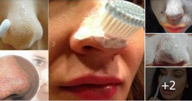 Sizi Siyah Noktalarınızdan Kurtaracak ve Cildinizi Bebeksi Yapacak Yöntem!