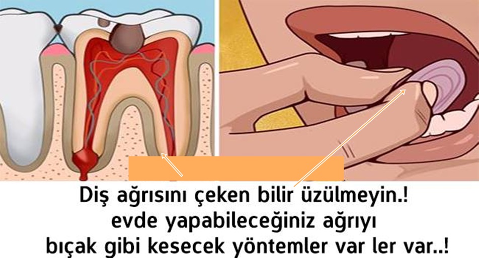 DİŞ AĞRISINI ÇEKEN BİLİR ÜZÜLMEYİN EVDE YAPABİLECEĞİNİZ AĞRIYI ANINDA GİBİ BİTİRECEK YÖNTEMLER VAR .!