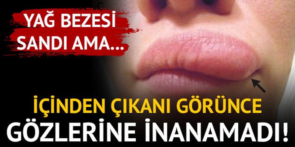 YAĞ BEZESİ SANDI, İÇİNDEN ÇIKANI GÖRÜNCE GÖZLERİNE İNANAMADI...