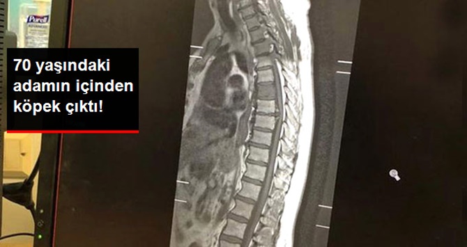 70 Yaşında ki Adamın İçinden Köpek Çıktı…