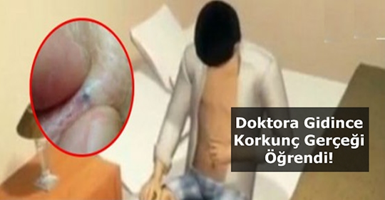Kaşınıyor bahanesi ile doktora gitti