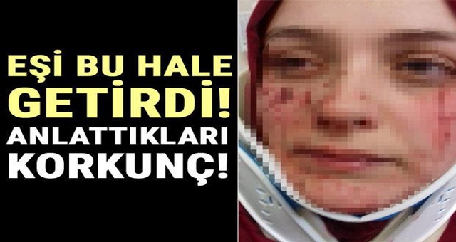 Eşi Bu Hale Getirdi ! Anlattıkları Krkunç