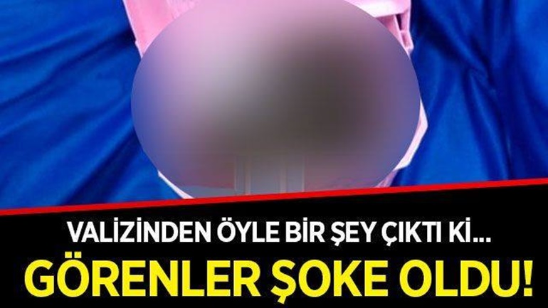 Valizinden öyle bir şey çıktı ki... Görenler şoke oldu!
