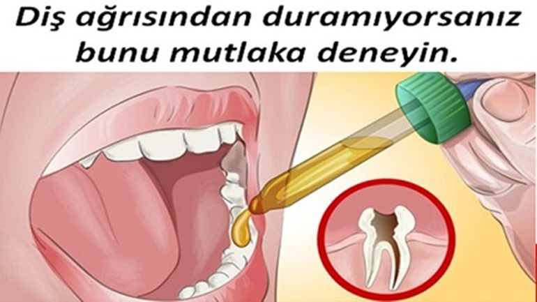 Diş ağrısından duramıyorsanız bunu mutlaka deneyin.