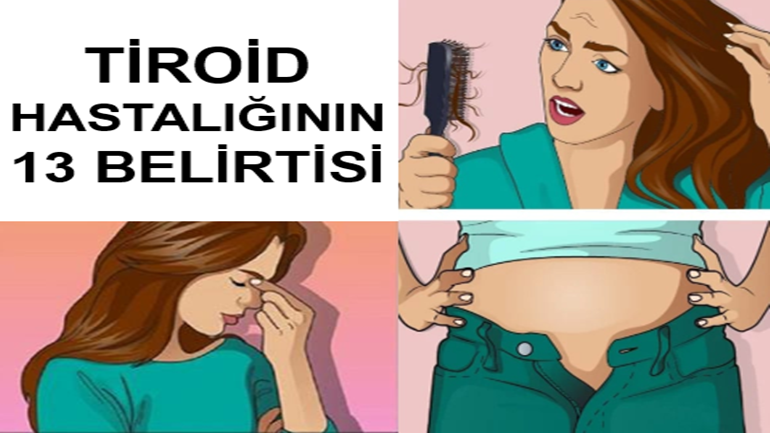 Tiroit H-astalığının 13 Belirtisi