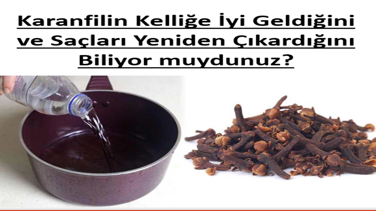 Karanfili Kelliğe İyi Geldiğini ve Saçları Yeniden Çıkardığını Biliyor muydunuz?