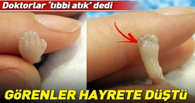 Doktorlar “Tıbbi Atık” Dedi, Görenler Hayrete Düştü