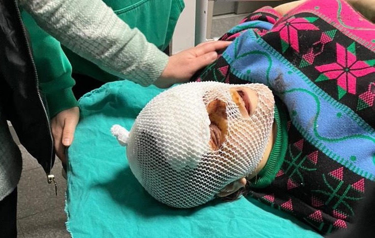 Eşinin boşanma teklifini reddetti bu hale geldi